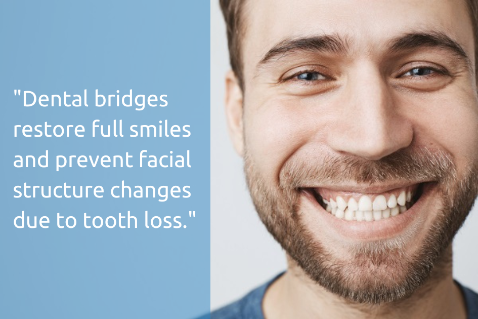 Dental bridges restore full smiles and prevent facial structure due to tooth loss. Dental Bridge